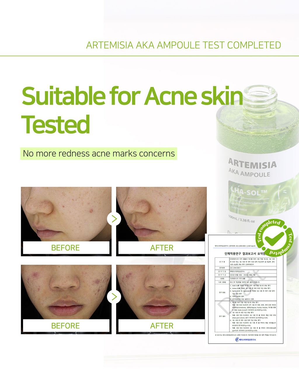Dr. Sante Artemisia AKA Ampoule 50ml