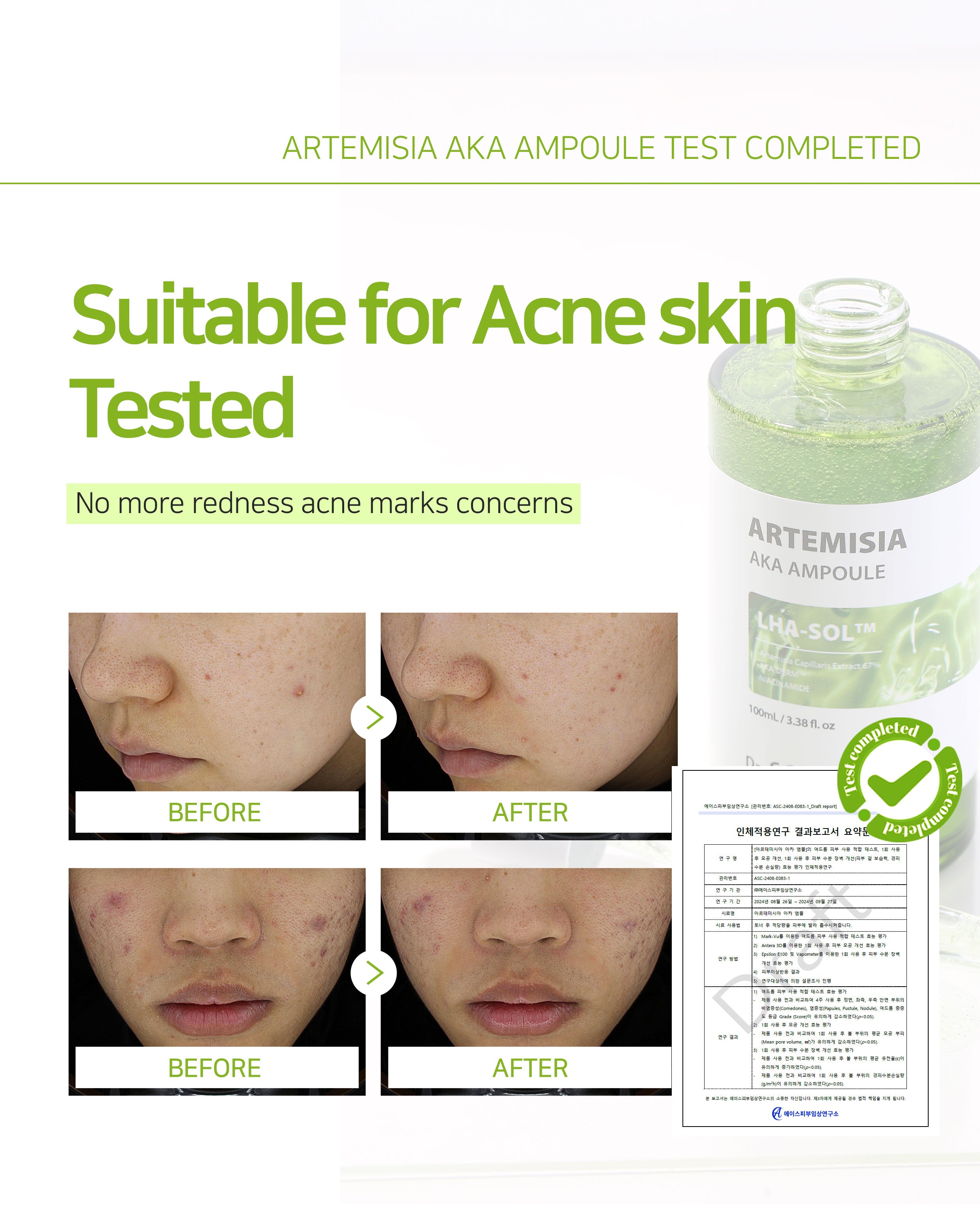 Dr. Sante Artemisia AKA Ampoule 50ml