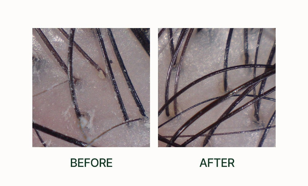 AZH Daily Fresh Hair Spa