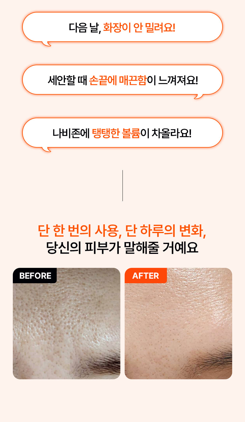 INJECTIER AMPOULE TIP SHOT