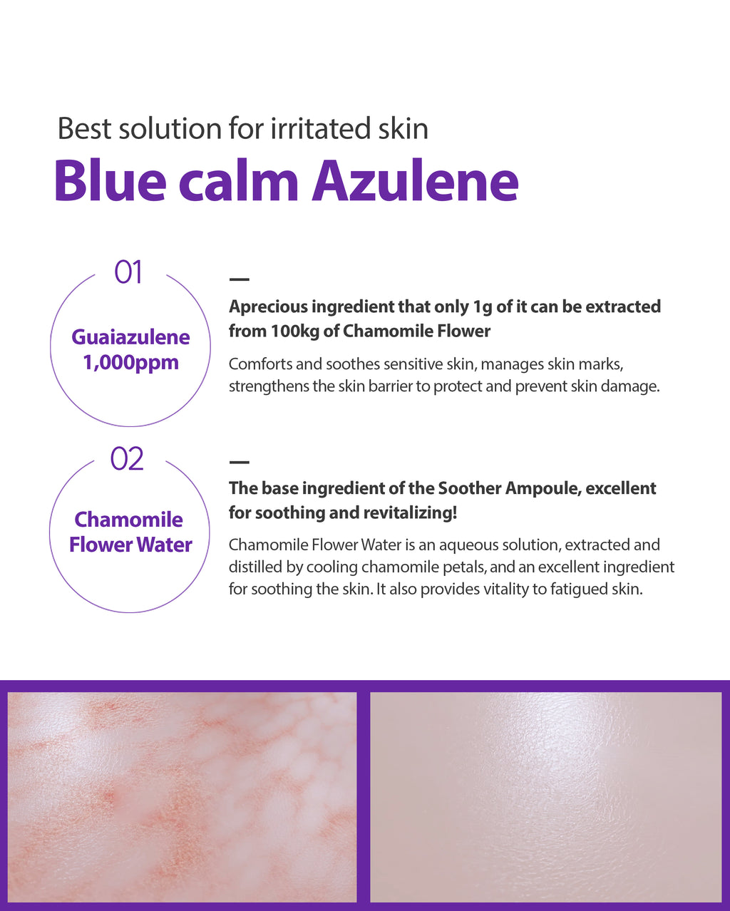 Dr. Sante Azulene Soother Ampoule 50ml
