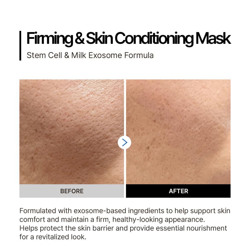 Vemontes EXOGAR TRASER MASK (1ea)