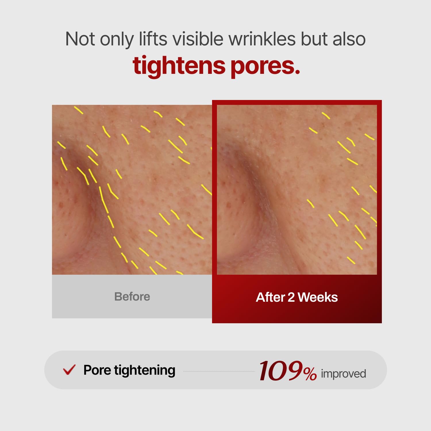Meditherapy  wrinkle-fit mask (7ea)
