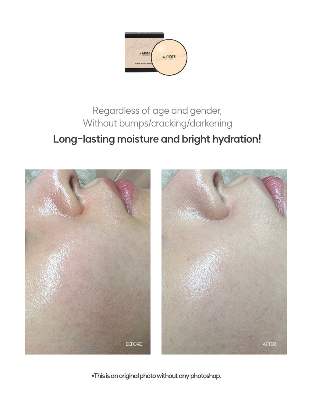 Dr. Sante Azulene Soother BB Cushion (Refill)