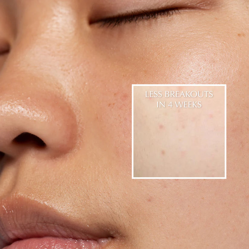 SHIFT Aroma Capsule Showerhead / Vanilla Pink